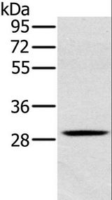 CLIC1 / NCC27 Antibody - Western blot analysis of Human testis tissue, using CLIC1 Polyclonal Antibody at dilution of 1:400.
