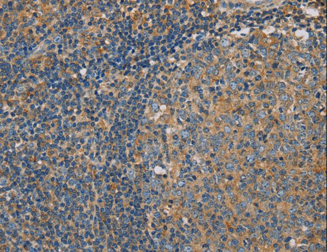 CLIC1 / NCC27 Antibody - Immunohistochemistry of paraffin-embedded Human tonsil using CLIC1 Polyclonal Antibody at dilution of 1:30.