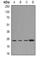 CLIC1 / NCC27 Antibody - Western blot analysis of CLIC1 expression in HeLa (A); HepG2 (B); mouse lung (C); rat kidney (D) whole cell lysates.