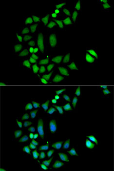 CLIC1 / NCC27 Antibody - Immunofluorescence analysis of MCF7 cells using CLIC1 antibody. Blue: DAPI for nuclear staining.