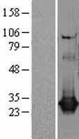 CLIC1 / NCC27 Protein - Western validation with an anti-DDK antibody * L: Control HEK293 lysate R: Over-expression lysate