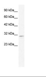 CLIC2 Antibody - HepG2 Cell Lysate.  This image was taken for the unconjugated form of this product. Other forms have not been tested.
