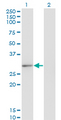 CLIC2 Antibody - Western Blot analysis of CLIC2 expression in transfected 293T cell line by CLIC2 monoclonal antibody (M01), clone 2C1.Lane 1: CLIC2 transfected lysate (Predicted MW: 28.4 KDa).Lane 2: Non-transfected lysate.