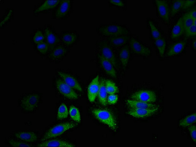 CLIC2 Antibody - Immunofluorescent analysis of HepG2 cells using CLIC2 Antibody at dilution of 1:100 and Alexa Fluor 488-congugated AffiniPure Goat Anti-Rabbit IgG(H+L)