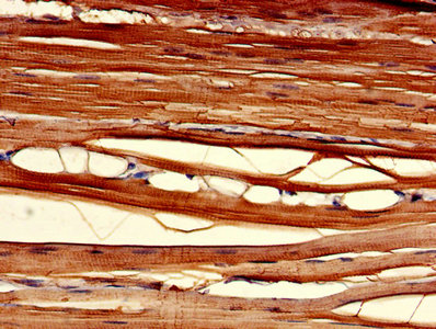 CLIC2 Antibody - Immunohistochemistry of paraffin-embedded human skeletal muscle tissue using CLIC2 Antibody at dilution of 1:100