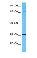 CLIC2 Antibody - Western blot of CLIC2 Antibody with human Fetal Liver lysate.  This image was taken for the unconjugated form of this product. Other forms have not been tested.
