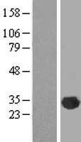 CLIC2 Protein - Western validation with an anti-DDK antibody * L: Control HEK293 lysate R: Over-expression lysate
