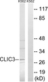 CLIC3 Antibody - Western blot analysis of lysates from K562 cells, using CLIC3 Antibody. The lane on the right is blocked with the synthesized peptide.