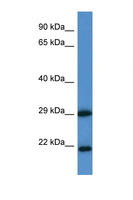CLIC3 Antibody - CLIC3 antibody Western blot of 1 Cell lysate. Antibody concentration 1 ug/ml.  This image was taken for the unconjugated form of this product. Other forms have not been tested.