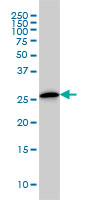 CLIC3 Antibody - CLIC3 monoclonal antibody (M02), clone 3F8 Western blot of CLIC3 expression in A-431.