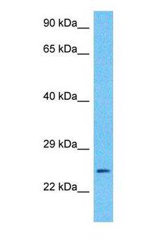 CLIC3 Antibody - Western blot of CLIC3 Antibody with human Fetal Lung lysate.  This image was taken for the unconjugated form of this product. Other forms have not been tested.
