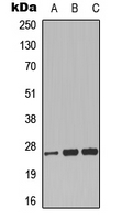 CLIC3 Antibody - Western blot analysis of CLIC3 expression in K562 (A); rat brain (B); rat lung (C) whole cell lysates.