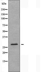 CLIC3 Antibody - Western blot analysis of extracts of K562 cells using CLIC3 antibody.