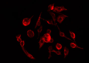 CLIC3 Antibody - Staining MCF-7 cells by IF/ICC. The samples were fixed with PFA and permeabilized in 0.1% Triton X-100, then blocked in 10% serum for 45 min at 25°C. The primary antibody was diluted at 1:200 and incubated with the sample for 1 hour at 37°C. An Alexa Fluor 594 conjugated goat anti-rabbit IgG (H+L) Ab, diluted at 1/600, was used as the secondary antibody.