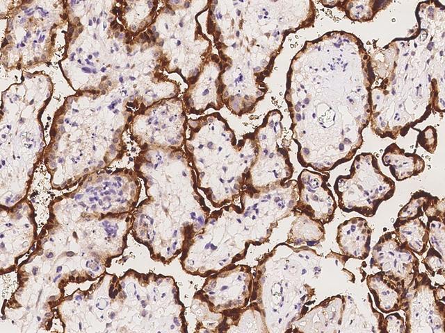 CLIC3 Antibody - Immunochemical staining of human CLIC3 in human placenta with rabbit polyclonal antibody at 1:1000 dilution, formalin-fixed paraffin embedded sections.