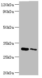 CLIC4 Antibody - Western blot All lanes: Chloride intracellular channel protein 4 antibody at 5µg/ml Lane 1: Mouse kidney tissue Lane 2: Mouse ovarian tissue Secondary Goat polyclonal to rabbit IgG at 1/10000 dilution Predicted band size: 29 kDa Observed band size: 29 kDa