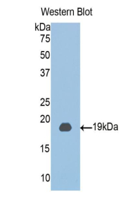 CLIC4 Antibody - Western blot of recombinant CLIC4.  This image was taken for the unconjugated form of this product. Other forms have not been tested.