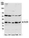 CLIC4 Antibody - Detection of human and mouse CLIC4 by western blot. Samples: Whole cell lysate (50 µg) from HeLa, HEK293T, Jurkat, mouse TCMK-1, and mouse NIH 3T3 cells prepared using NETN lysis buffer. Antibody: Affinity purified rabbit anti-CLIC4 antibody used for WB at 0.1 µg/ml. Detection: Chemiluminescence with an exposure time of 10 seconds.