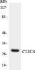 CLIC4 Antibody - Western blot analysis of the lysates from HeLa cells using CLIC4 antibody.