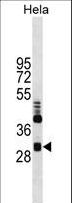 CLIC4 Antibody - Western blot of anti-CLIC4 Monoclonal Antibody in HeLa cell line lysates. CLIC4(arrow) was detected using the ascites antibody.