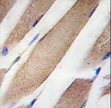 CLIC4 Antibody - Formalin-fixed and paraffin-embedded human skeletal muscle tissue reacted with CLIC4 Antibody , which was peroxidase-conjugated to the secondary antibody, followed by DAB staining. This data demonstrates the use of this antibody for immunohistochemistry; clinical relevance has not been evaluated.