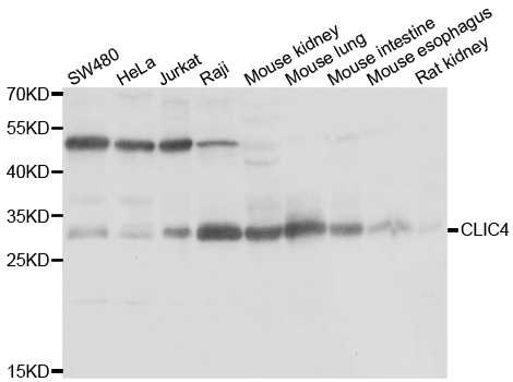 CLIC4 Antibody - Western blot analysis of extracts of various cell lines.