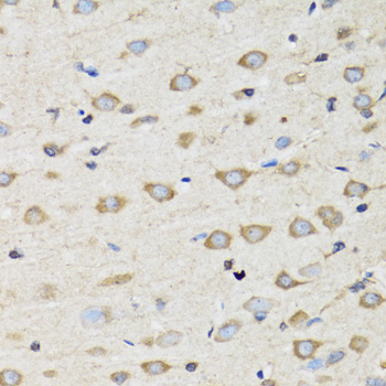 CLIC4 Antibody - Immunohistochemistry of paraffin-embedded rat brain tissue.