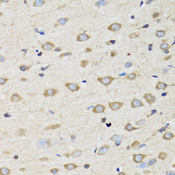 CLIC4 Antibody - Immunohistochemistry of paraffin-embedded rat brain tissue.
