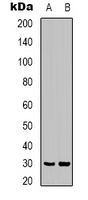 CLIC4 Antibody - Western blot analysis of CLIC4 expression in mouse brain (A); rat brain (B) whole cell lysates.