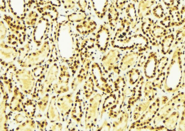 CLIC4 Antibody - 1:100 staining mouse kidney tissue by IHC-P. The sample was formaldehyde fixed and a heat mediated antigen retrieval step in citrate buffer was performed. The sample was then blocked and incubated with the antibody for 1.5 hours at 22°C. An HRP conjugated goat anti-rabbit antibody was used as the secondary.