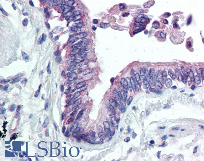 CLIC4 Antibody - Anti-CLIC4 antibody IHC of human lung. Immunohistochemistry of formalin-fixed, paraffin-embedded tissue after heat-induced antigen retrieval. Antibody concentration 20 ug/ml.  This image was taken for the unconjugated form of this product. Other forms have not been tested.