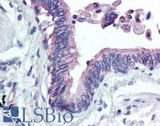 CLIC4 Antibody - Anti-CLIC4 antibody IHC of human lung. Immunohistochemistry of formalin-fixed, paraffin-embedded tissue after heat-induced antigen retrieval. Antibody concentration 20 ug/ml.  This image was taken for the unconjugated form of this product. Other forms have not been tested.
