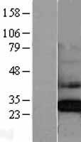 CLIC4 Protein - Western validation with an anti-DDK antibody * L: Control HEK293 lysate R: Over-expression lysate