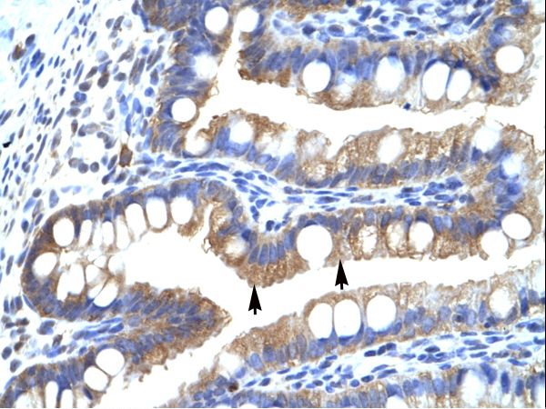 CLIC5 Antibody - CLIC5 antibody ARP35262_T100-CLIC5 (chloride intracellular channel 5) Antibody was used in IHC to stain formalin-fixed, paraffin-embedded human intestine.  This image was taken for the unconjugated form of this product. Other forms have not been tested.