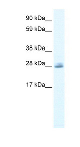 CLIC5 Antibody - CLIC5 antibody Western blot of Jurkat lysate. This image was taken for the unconjugated form of this product. Other forms have not been tested.