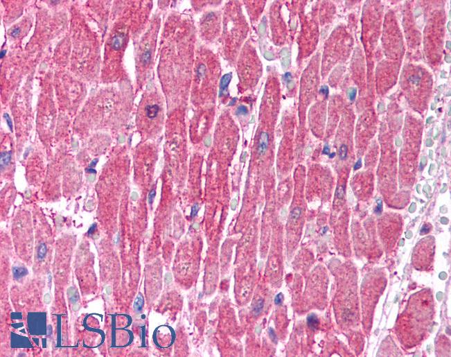 CLIC5 Antibody - Anti-CLIC5 antibody IHC of human heart. Immunohistochemistry of formalin-fixed, paraffin-embedded tissue after heat-induced antigen retrieval. Antibody concentration 5 ug/ml.  This image was taken for the unconjugated form of this product. Other forms have not been tested.