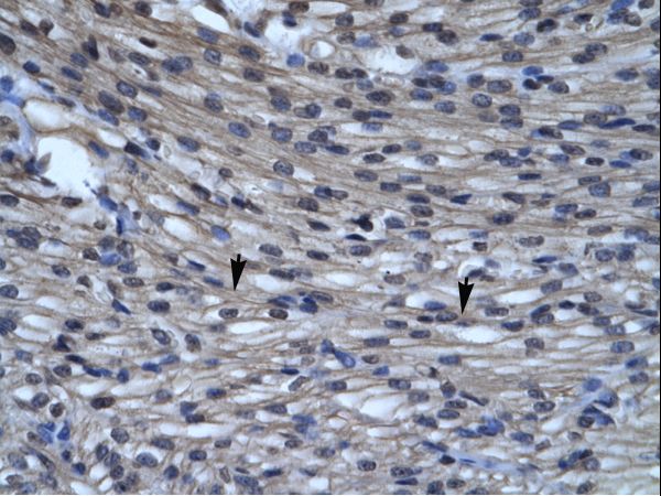 CLIC5 Antibody - Human Heart.  This image was taken for the unconjugated form of this product. Other forms have not been tested.