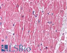 CLIC5 Antibody - Anti-CLIC5 antibody IHC of human heart. Immunohistochemistry of formalin-fixed, paraffin-embedded tissue after heat-induced antigen retrieval. Antibody concentration 5 ug/ml.  This image was taken for the unconjugated form of this product. Other forms have not been tested.