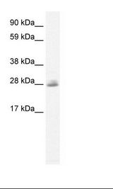 CLIC5 Antibody - Fetal Lung Lysate.  This image was taken for the unconjugated form of this product. Other forms have not been tested.