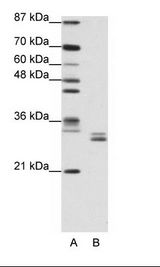CLIC5 Antibody - A: Marker, B: Jurkat Cell Lysate.  This image was taken for the unconjugated form of this product. Other forms have not been tested.