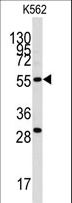 CLIC5 Antibody - Western blot of anti-CLIC5 Antibody in K562 cell line lysates (35 ug/lane). CLIC5(arrow) was detected using the purified antibody.
