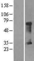 CLIC5 Protein - Western validation with an anti-DDK antibody * L: Control HEK293 lysate R: Over-expression lysate