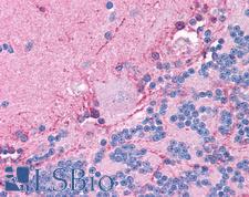 CLIC6 Antibody - Anti-CLIC6 antibody IHC of human brain, cerebellum. Immunohistochemistry of formalin-fixed, paraffin-embedded tissue after heat-induced antigen retrieval. Antibody concentration 5 ug/ml.  This image was taken for the unconjugated form of this product. Other forms have not been tested.