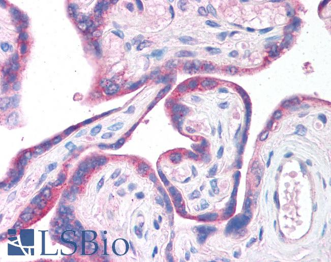 CLIC6 Antibody - Anti-CLIC6 antibody IHC of human placenta. Immunohistochemistry of formalin-fixed, paraffin-embedded tissue after heat-induced antigen retrieval. Antibody concentration 5 ug/ml.  This image was taken for the unconjugated form of this product. Other forms have not been tested.