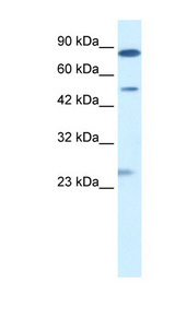 CLIC6 Antibody - CLIC6 antibody Western blot of Jurkat lysate. This image was taken for the unconjugated form of this product. Other forms have not been tested.
