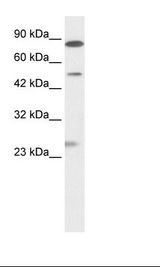 CLIC6 Antibody - Jurkat Cell Lysate.  This image was taken for the unconjugated form of this product. Other forms have not been tested.