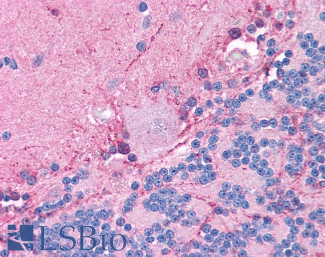 CLIC6 Antibody - Anti-CLIC6 antibody IHC of human brain, cerebellum. Immunohistochemistry of formalin-fixed, paraffin-embedded tissue after heat-induced antigen retrieval. Antibody concentration 5 ug/ml.  This image was taken for the unconjugated form of this product. Other forms have not been tested.