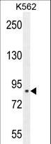 CLIC6 Antibody - CLIC6 Antibody western blot of K562 cell line lysates (35 ug/lane). The CLIC6 antibody detected the CLIC6 protein (arrow).
