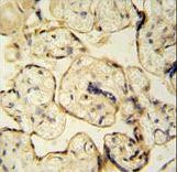 CLIC6 Antibody - CLIC6 antibody immunohistochemistry of formalin-fixed and paraffin-embedded human placenta tissue tissue followed by peroxidase-conjugated secondary antibody and DAB staining.