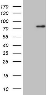 CLINT1 Antibody - HEK293T cells were transfected with the pCMV6-ENTRY control. (Left lane) or pCMV6-ENTRY CLINT1. (Right lane) cDNA for 48 hrs and lysed. Equivalent amounts of cell lysates. (5 ug per lane) were separated by SDS-PAGE and immunoblotted with anti-CLINT1.